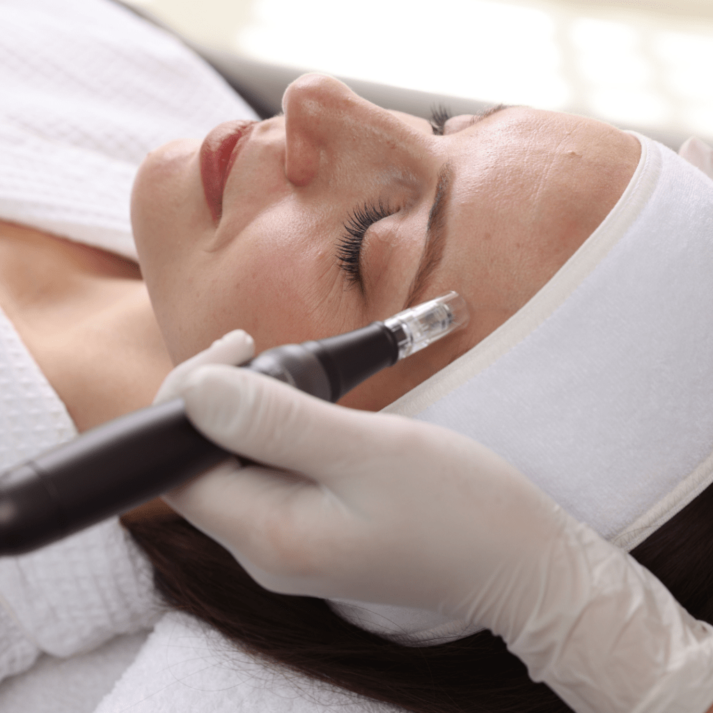 microneedling aesthetics services by patricia